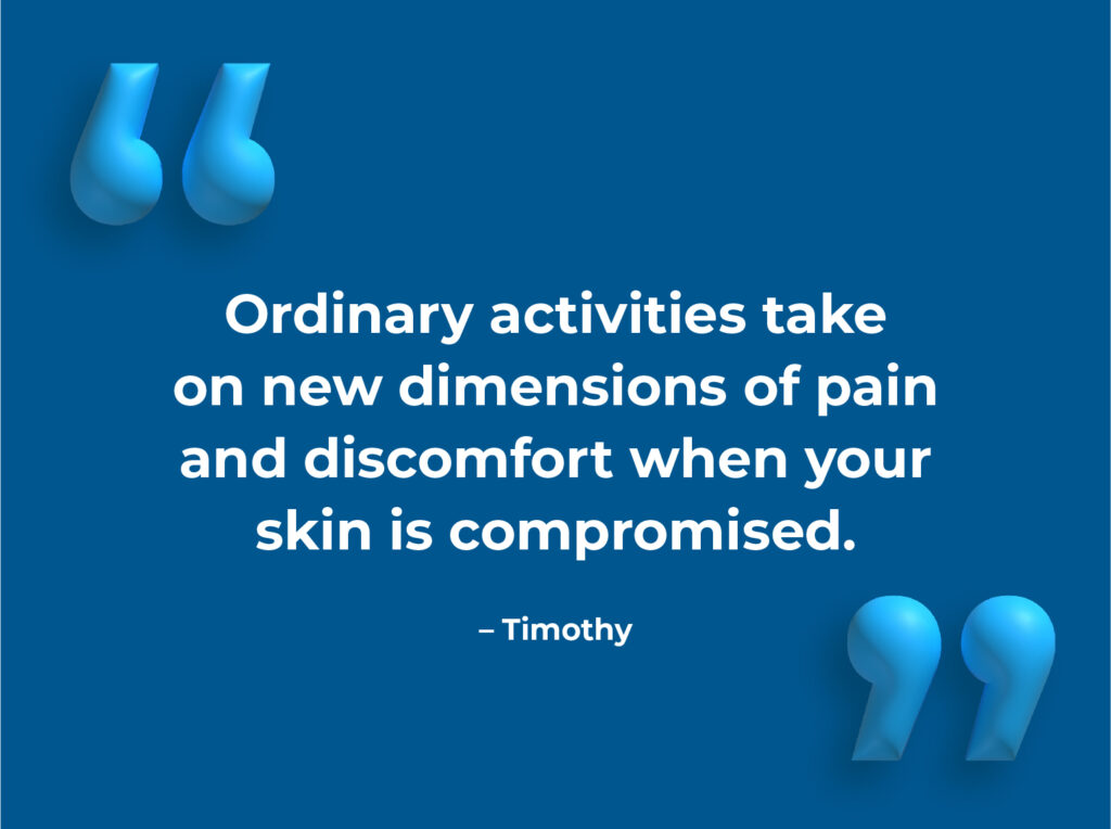 Ordinary activities take on new dimensions of pain and discomfort when your skin is compromised - Timothy