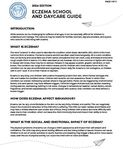 Eczema School and Daycare Guide 2024 English Print